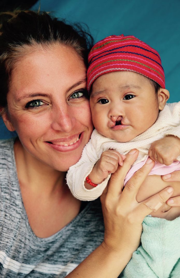 Tessa de Goede vertrok naar Guatemala om haar Spaans te verbeteren, maar besloot om kinderen met schisis (in de volksmond een hazenlip genoemd) te helpen.