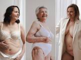 5 vrouwen gaan uit de kleren om hun kwetsbare lichaam te tonen: “Mijn buik hangt als een soort zakje”