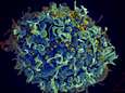 Oudste patiënt (66) ooit genezen van hiv na stamceltransplantatie