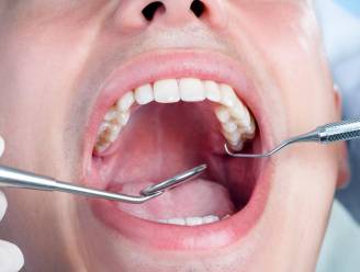 Tandartsen vragen regering om ziekteverzekering meer te laten dekken