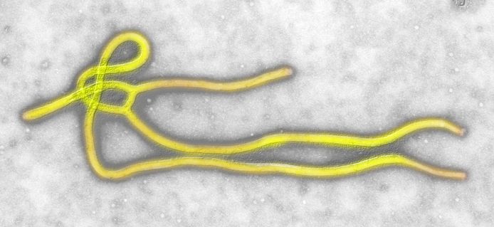 Het ebolavirus.
