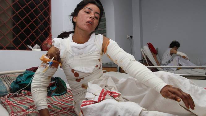 Grièvement brûlée pour avoir refusé de se marier