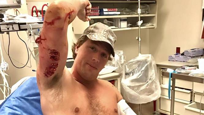 Nederlandse bioloog overleeft aanval van haai: meer dan 100 hechtingen