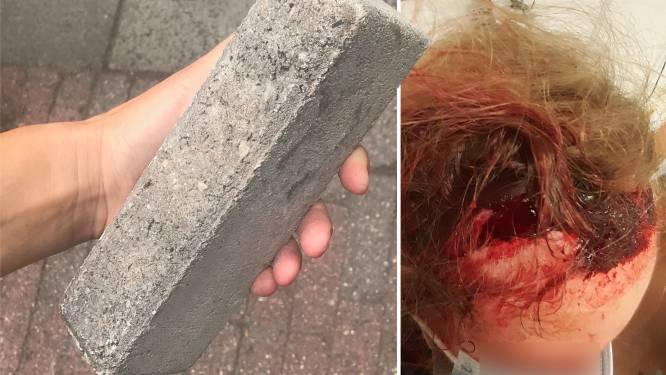 Ashley (16) uit Creil kreeg een grote steen tegen haar hoofd: ‘Niet fijn om je dochter bloedend in de bus te zien zitten’