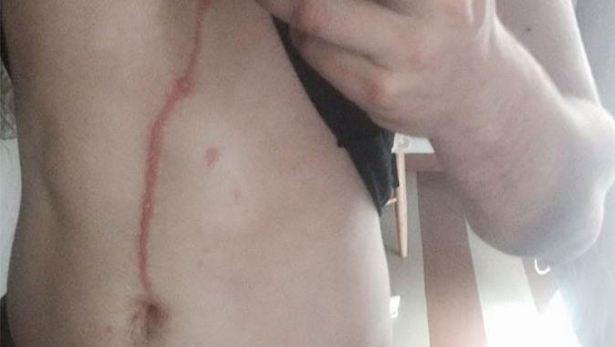 Horrorspin Dringt Lichaam Van Toerist Op Bali Binnen Buitenland Ad Nl