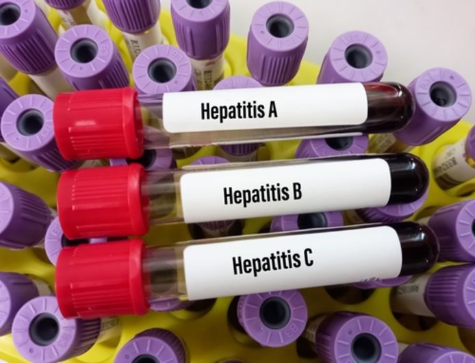 Bij de getroffen kinderen zijn de gebruikelijke hepatitisvirussen (A tot E) niet opgespoord.