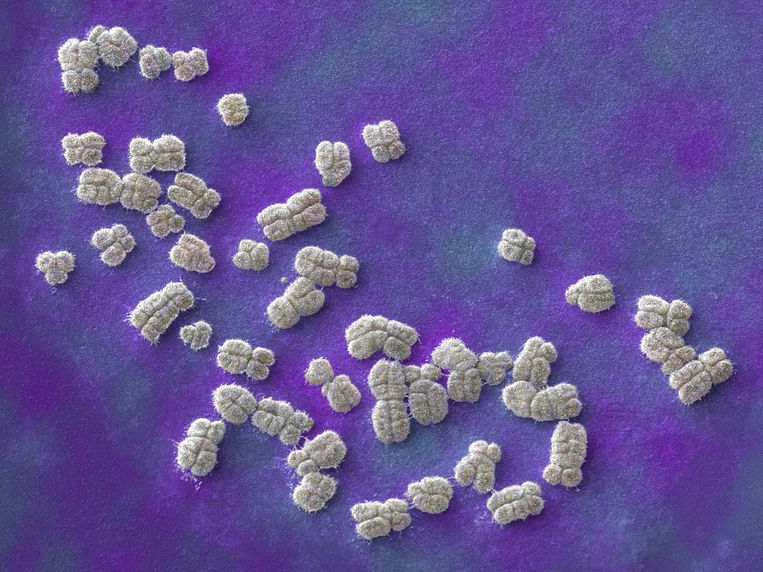 Een microscoopfoto van menselijk DNA, ingepakt in chromosomen, de vorm die ze aannemen vlak voor celdeling.  Beeld ANP / Science Photo Library