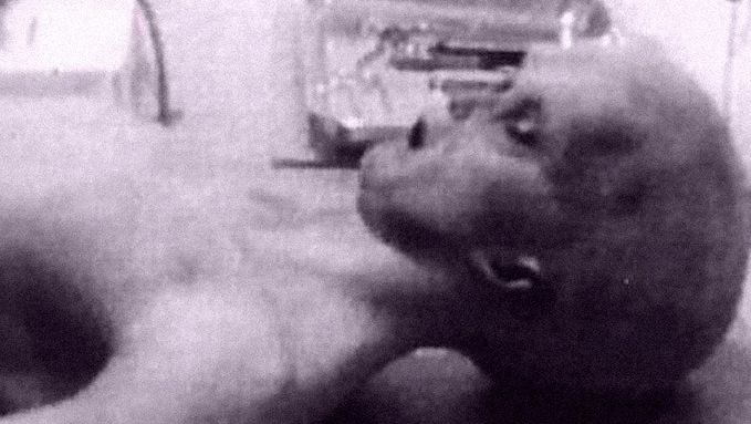 Une image issue de la vidéo de la prétendue autopsie d'un alien retrouvé à Roswell après le crash en 1947.