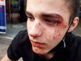 Jarno (16) werd met fietsketting in elkaar geslagen aan station van Deinze, maar parket klasseert de zaak: “Dit valt niet uit te leggen, wij zijn razend”