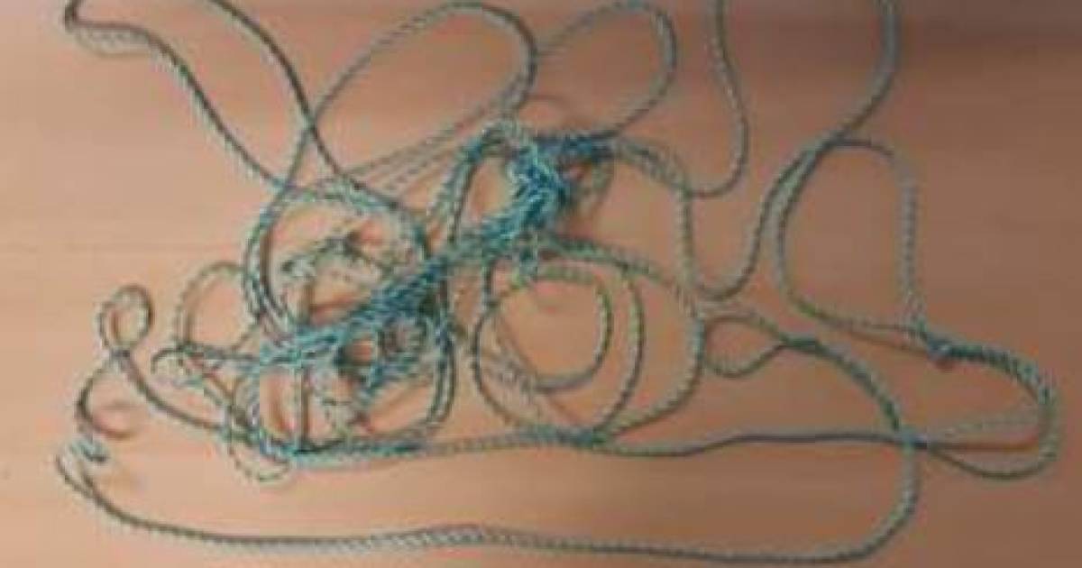 Politie ontdekt ‘levensgevaarlijk touwtje‘: touw op ooghoogte tussen twee bomen gespannen.