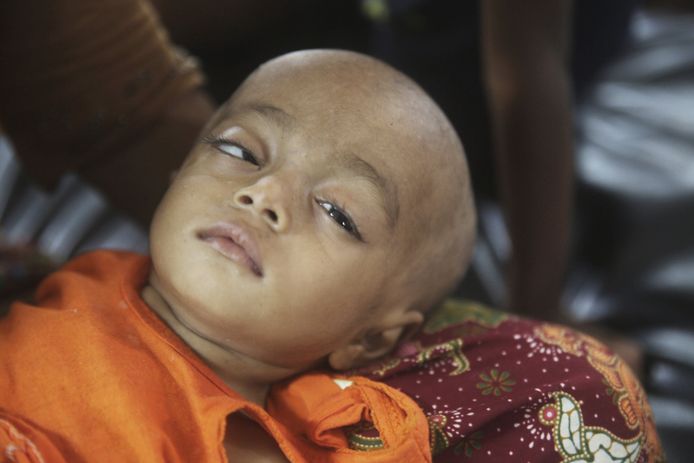 Sahida, een jong Rohingya-kind rust in de armen van haar moeder in het vluchtelingenkamp.