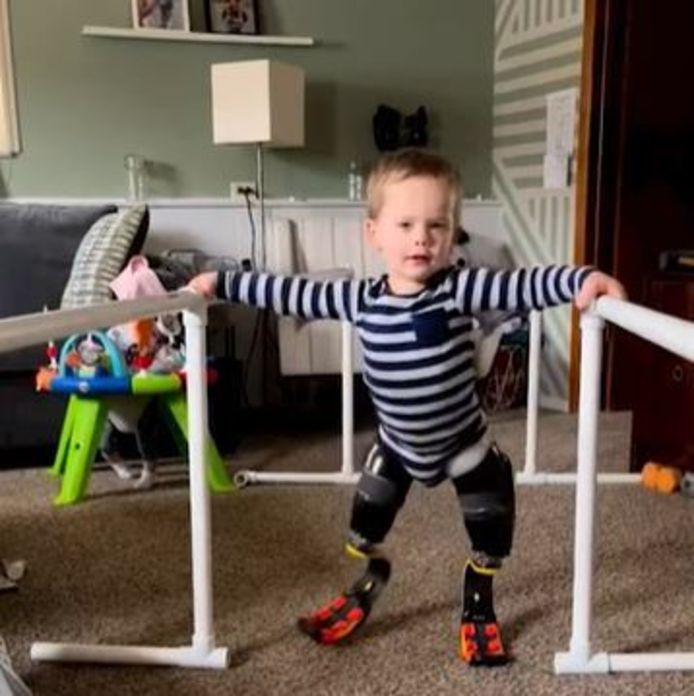 De 2-jarige Louie Brown kan na een dubbele amputatie weer lopen dankzij protheses.