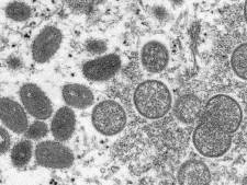 Face à la flambée de la variole du singe, l'OMS conseille de réduire le nombre de ses partenaires sexuels
