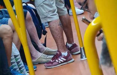 Man verdacht van apenpokken in metro Madrid ontkent gerucht: “Er groeien tumoren op mijn zenuwen en dat is niet besmettelijk”