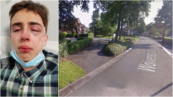 Alec Dujardin (17) uit Stasegem, kort na het ongeval waarin hij betrokken raakte in de Wolvenstraat in Kortrijk (rechts).